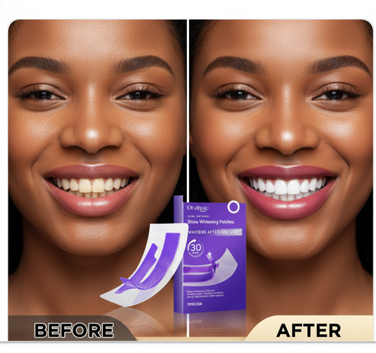 GlowFit Pearl Smile Whitening Strips